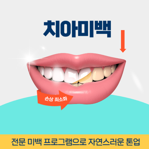 부천치과 부천시 치과 치아미백