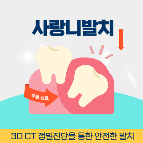 부천치과 부천시 치과 사랑니 발치
