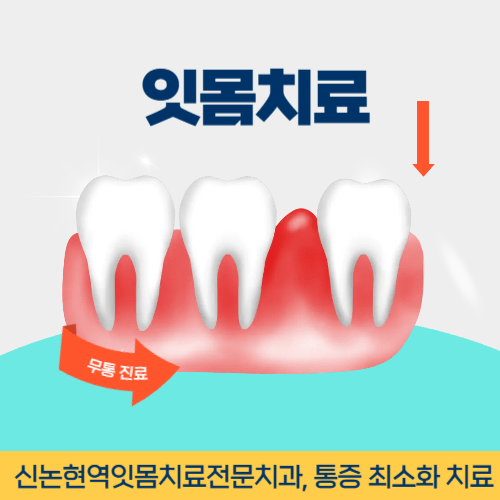 부천치과 부천시 치과 잇몸치료
